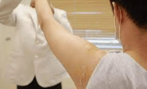 어깨통증 원인 및 증상 총정리