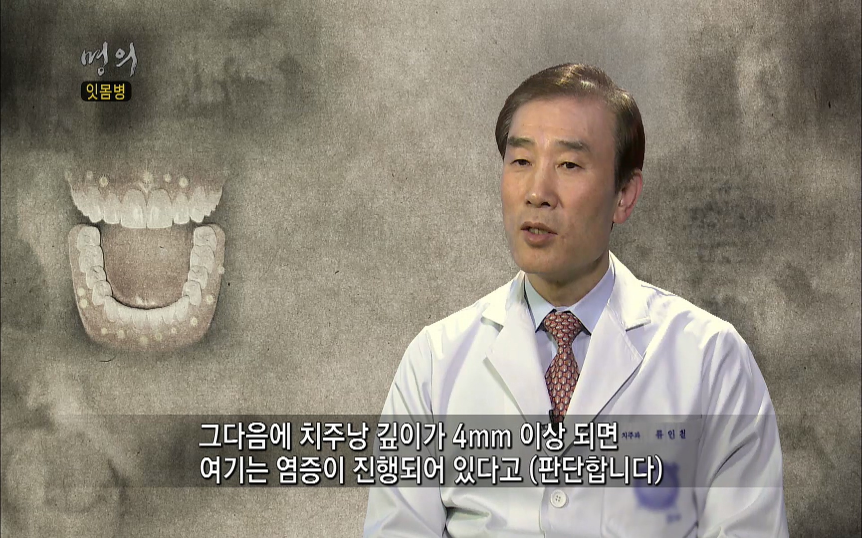 EBS 명의 헬스케어 - TV - 교육의 중심 EBS2015년 1월 16일 (금) 밤 9시 50분, EBS1.mp4_20220505_145338.015.jpg