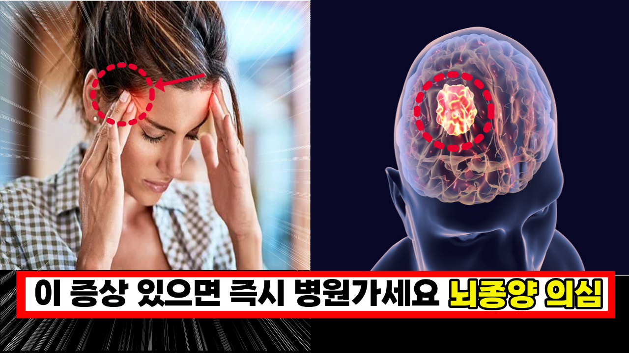  '젊다고 괜찮은게 아닙니다' 20~30대도 피할수 없는 뇌종양 초기 증상 5가지