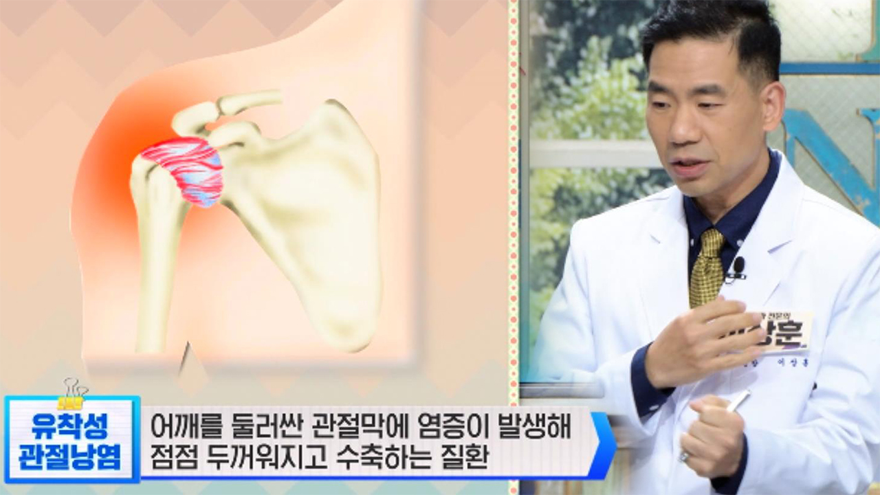  좋은아침 비타민D부족 골다공증치료완치법 #유착성관절낭염 #칼슘섭취 #골다공증원인 #골다공증뼈건강밥상 #케일칼슘 #MBP효능 #우유칼슘 #칼슘마그네슘식품 #뼈건강튼튼운동법