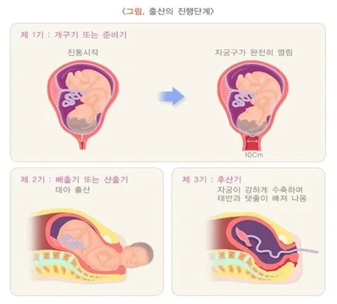 출산 후 자궁수축 기간_9