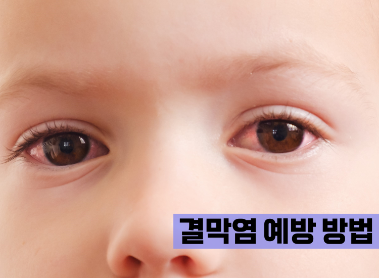 결막염 예방 방법