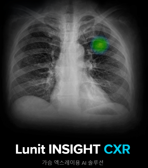 코스닥 상장심사 루닛 장외주식 720억 원 2
