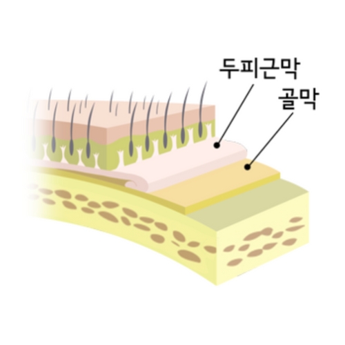 근막-골막