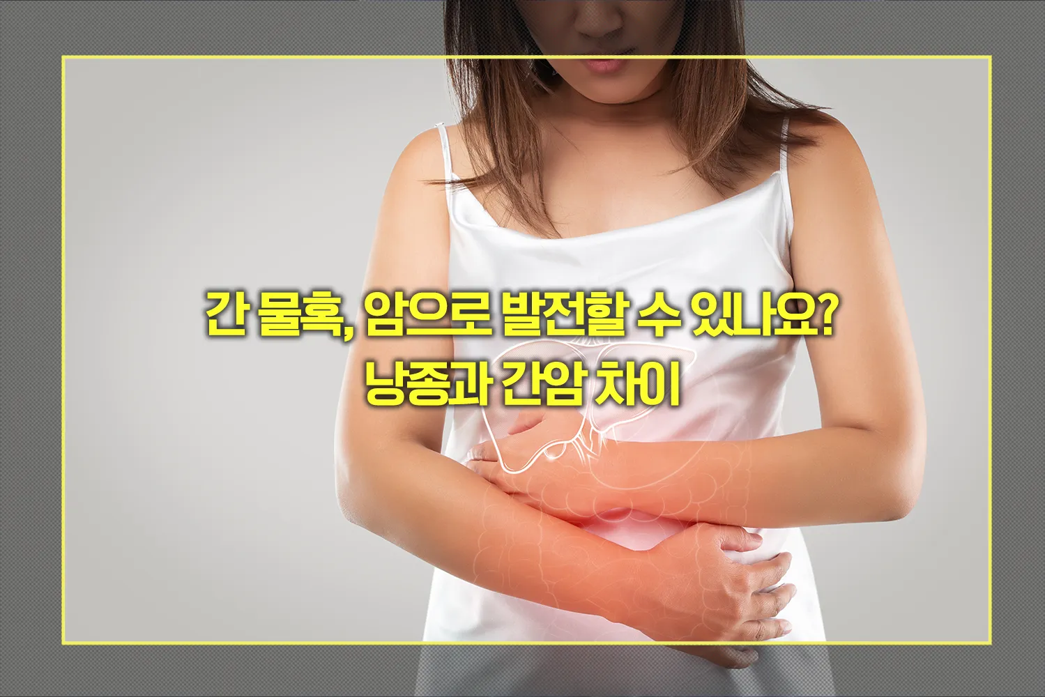 간 물혹 낭종과 간암 차이