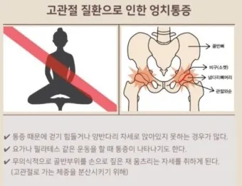 고관절 통증 증상 확인하기_2