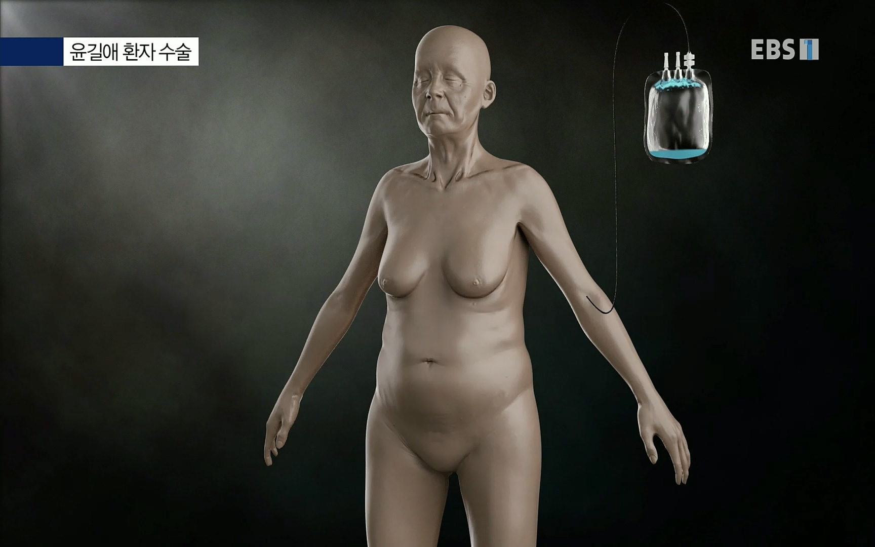 EBS 명의 헬스케어 - TV - 교육의 중심 EBS[명의 스페셜] 공포의 암, 췌장암, 담도암, 담낭암.mp4_20220902_210908.119.jpg