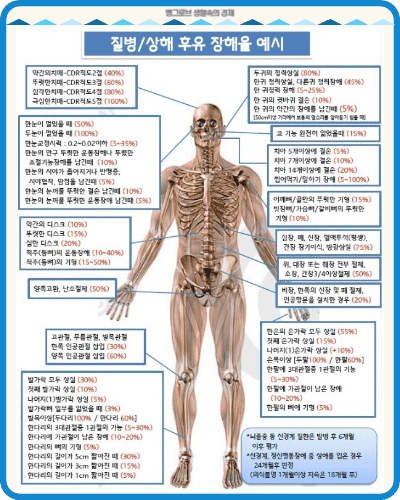 후유 장해율 예시
