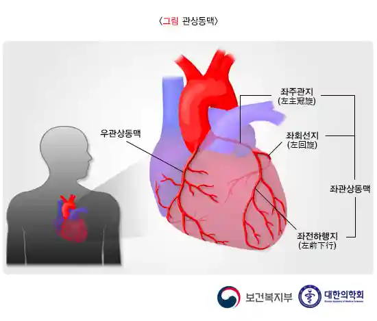 심장의 관상동맥