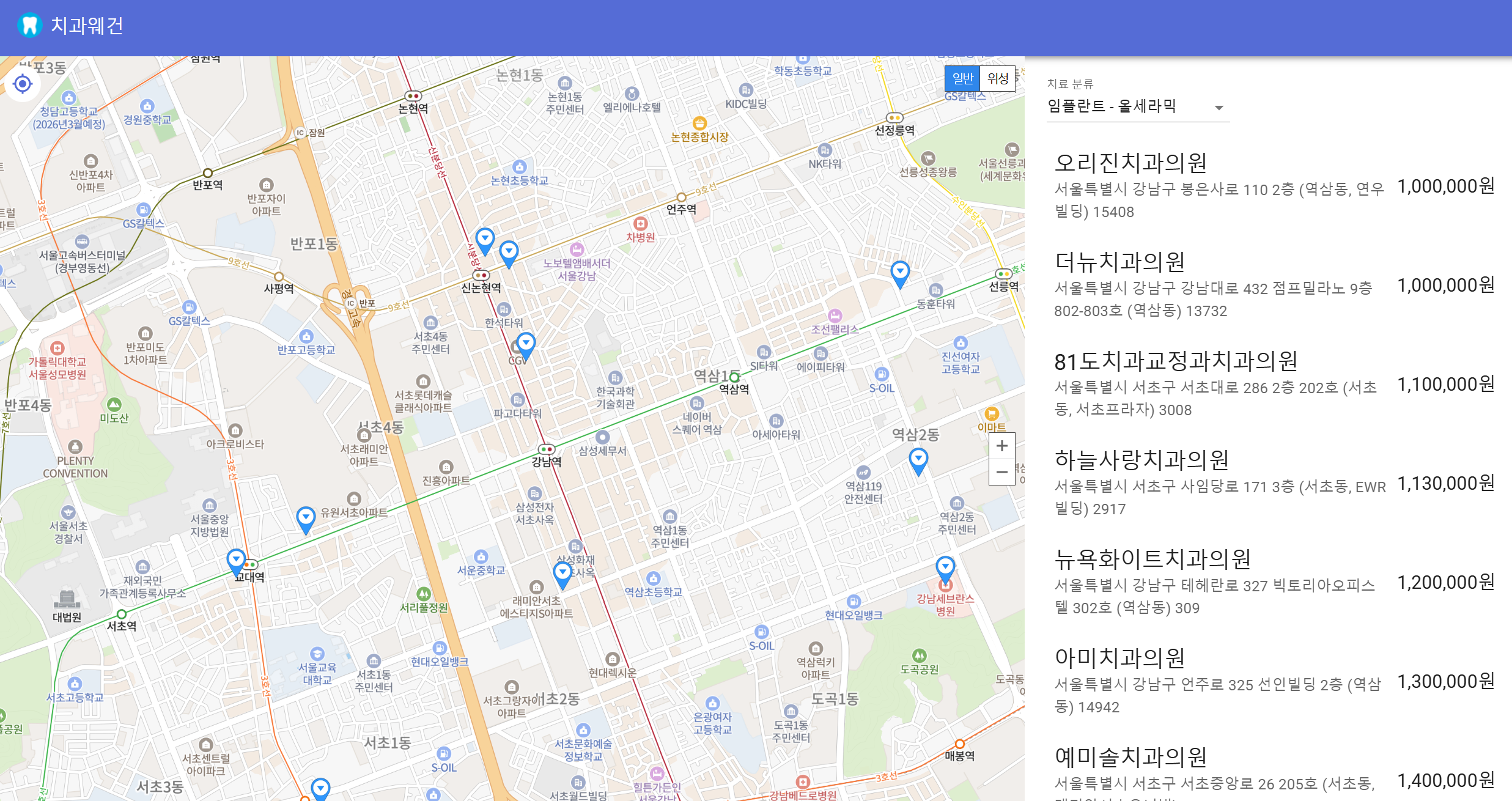 임플란트 가격 비교 사이트