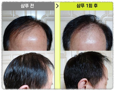 판매 1위 그래비티 삼푸 입증 효과 안내 이미지