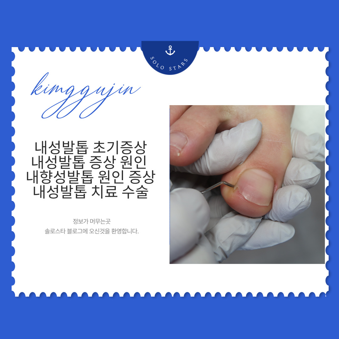 내성발톱 사진