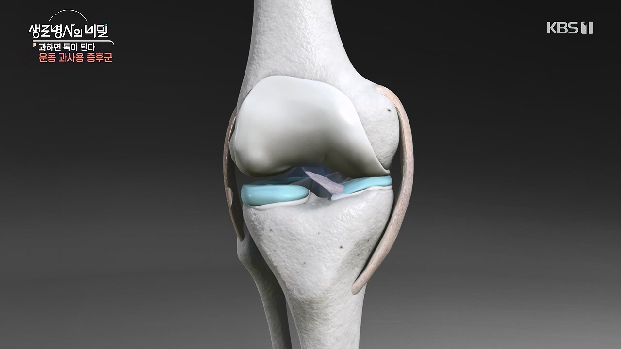 생로병사의 비밀.E918.240704p-NEXT.mp4_20240704_201614.500.jpg