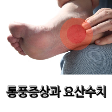  방치하면 위험한 통풍 원인 및 증상 그리고 치료와음식, 요산수치 까지 알고계셔야되요!!