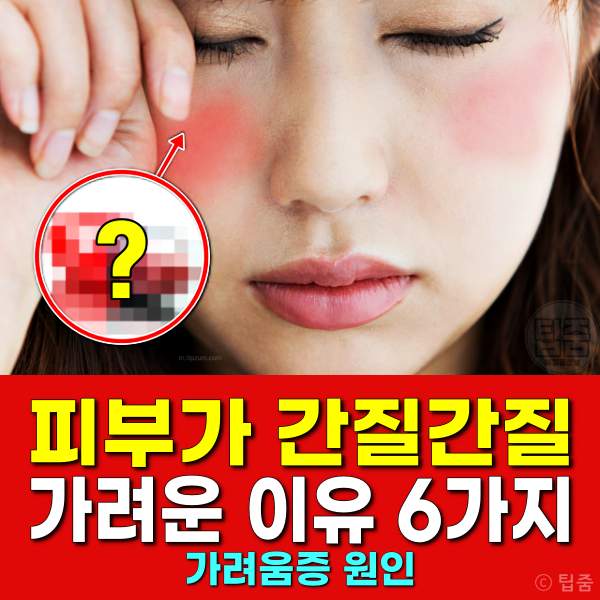 피부가 가려운 이유,얼굴이 간질간질,가려움증 원인