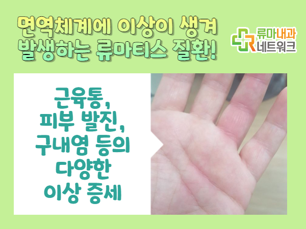 치료 알아야 할 점이 있다면? 섬유근육통 병원증상 2