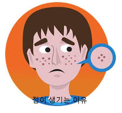  점 생기는 이유