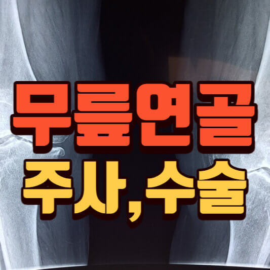 무릎연골원인-증상-치료-주사