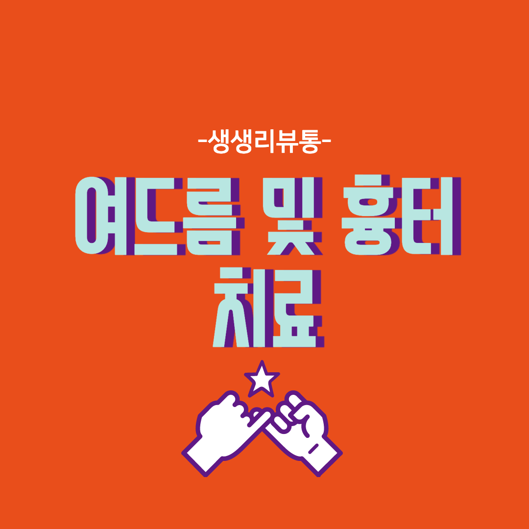  여드름 및 흉터 레이저 치료 뭐가 좋을까?(pdt, 프락셀, 이소티논)