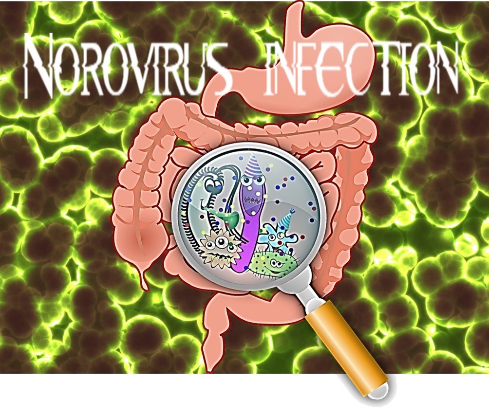 노로바이러스 감염&#44; 증상&#44; 예방 메인 그림