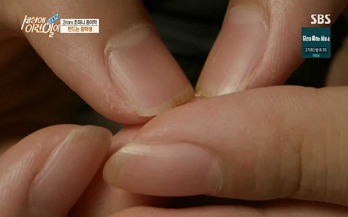 순간포착 세상에 이런일이.E1194.220823.H265p-BULDU.mp4_20220824_174559.128.jpg