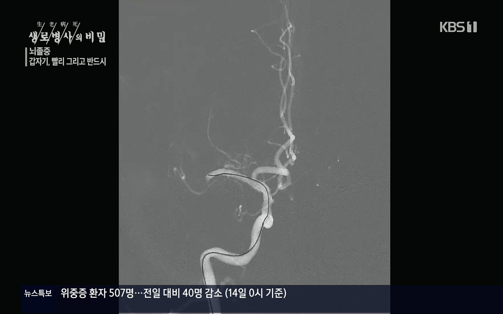 생로병사의 비밀.E835p.H264-F1RST.mp4_20220917_181732.761.jpg