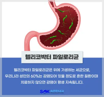 헬리코박터균 제균 치료 치료방법 성공률_4