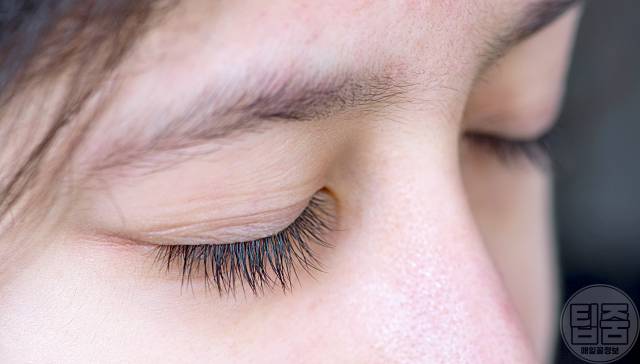 눈 따갑고 눈물 안구건조증 해결 눈뻑뻑함 이물감 눈건조증 원인