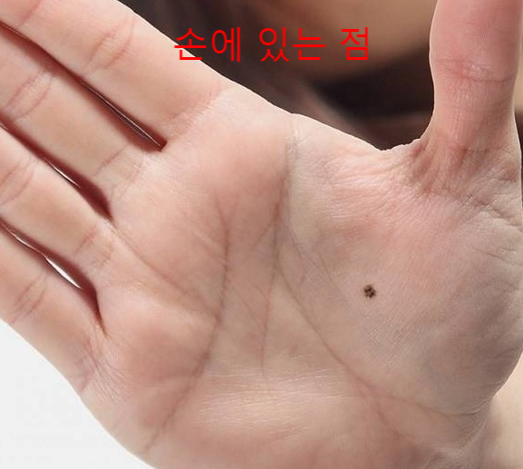  [점의 위치] 손에 있는 점과 그 위치에 따른 관상, 심심풀이