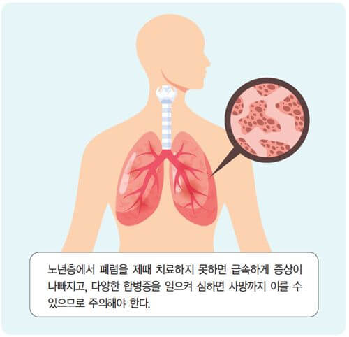 폐렴 증상