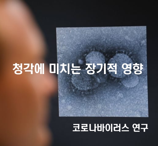  [연구] 코로나 바이러스 - 청각에 미치는 장기적 영향 조사