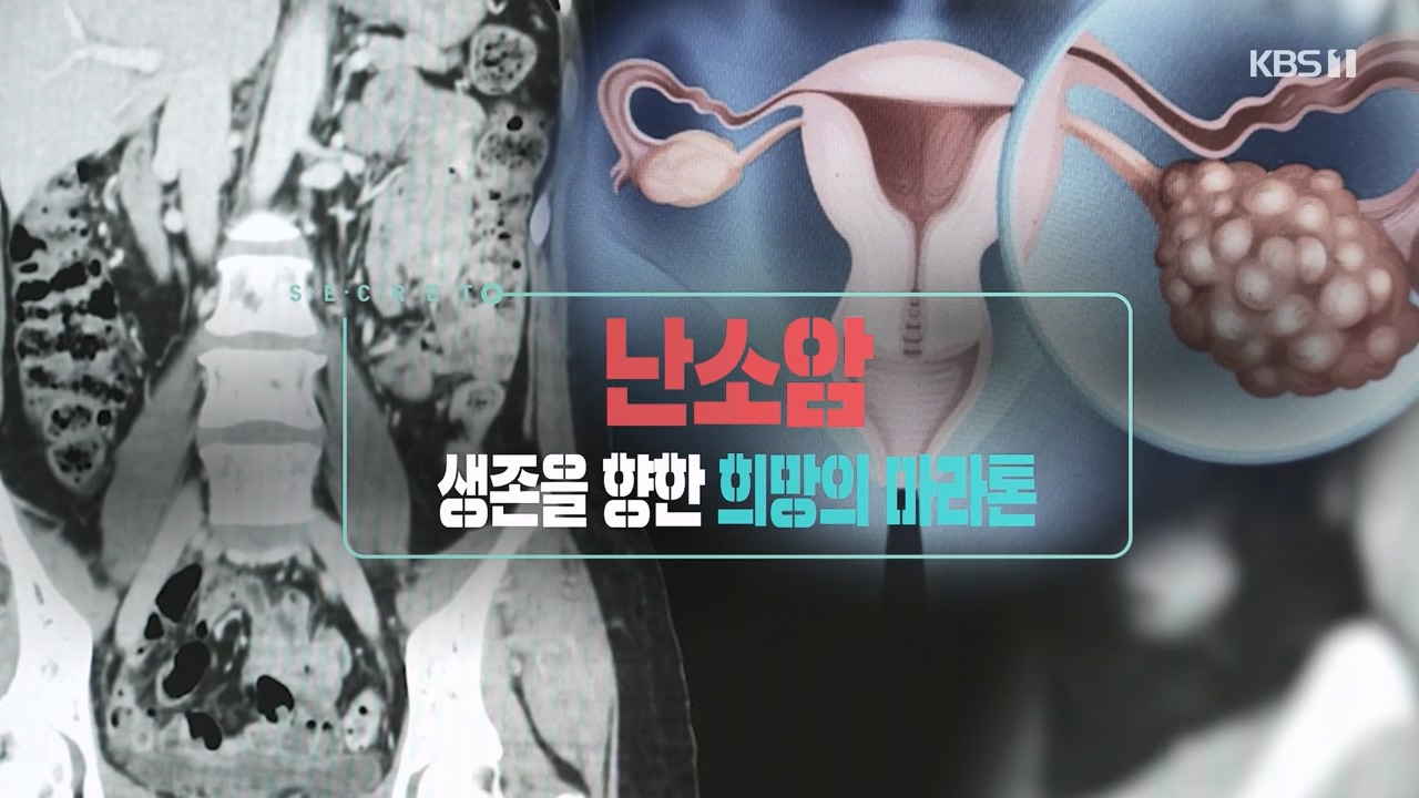 생로병사의 비밀.E878.230803p-NEXT.mp4_20230805_153524.091.jpg