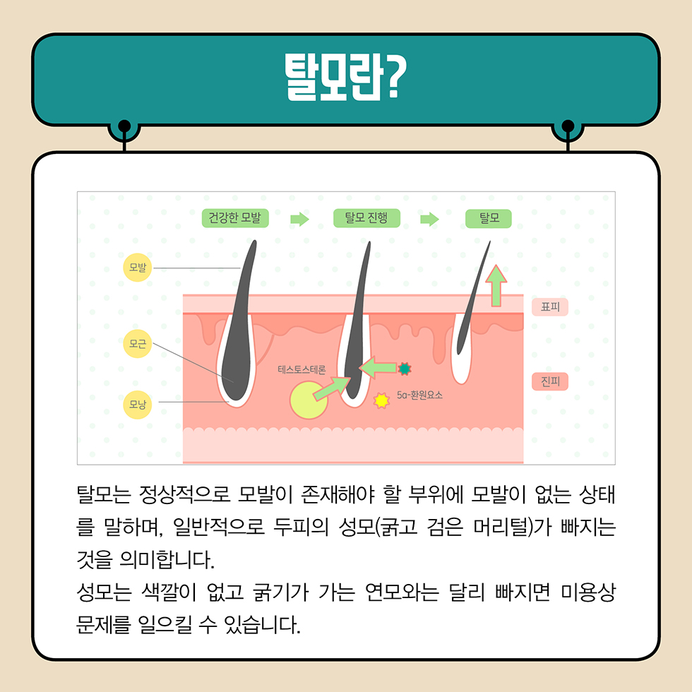  탈모 걱정 끝! 원인부터 해결책까지 알아보는 탈모 백과사전