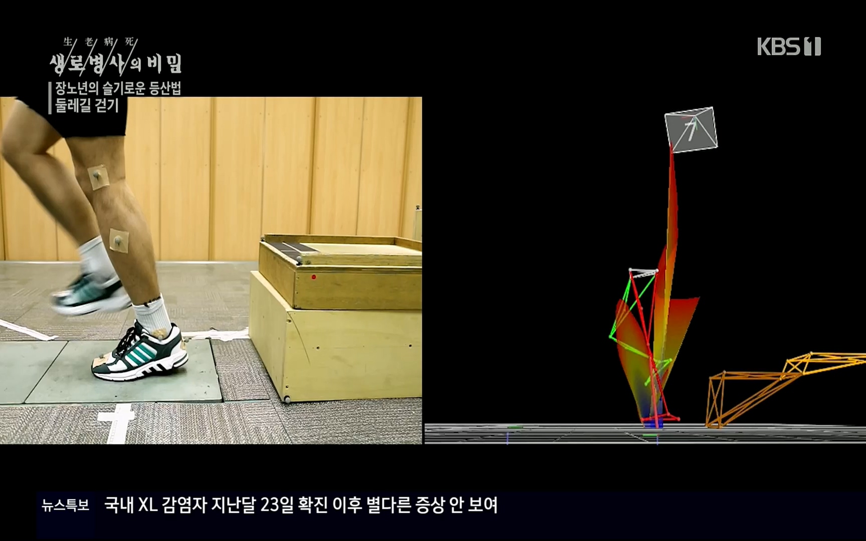 생로병사의 비밀.E816.220413p.H264-F1RST.mp4_20220414_192710.389.jpg