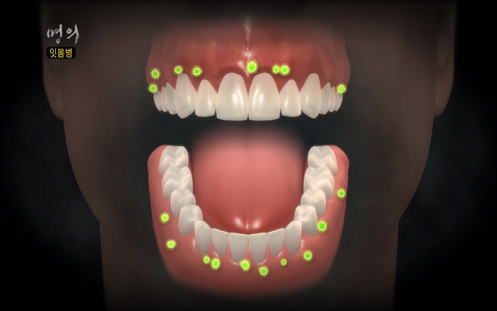 EBS 명의 헬스케어 - TV - 교육의 중심 EBS2015년 1월 16일 (금) 밤 9시 50분, EBS1.mp4_20220505_150402.400.jpg