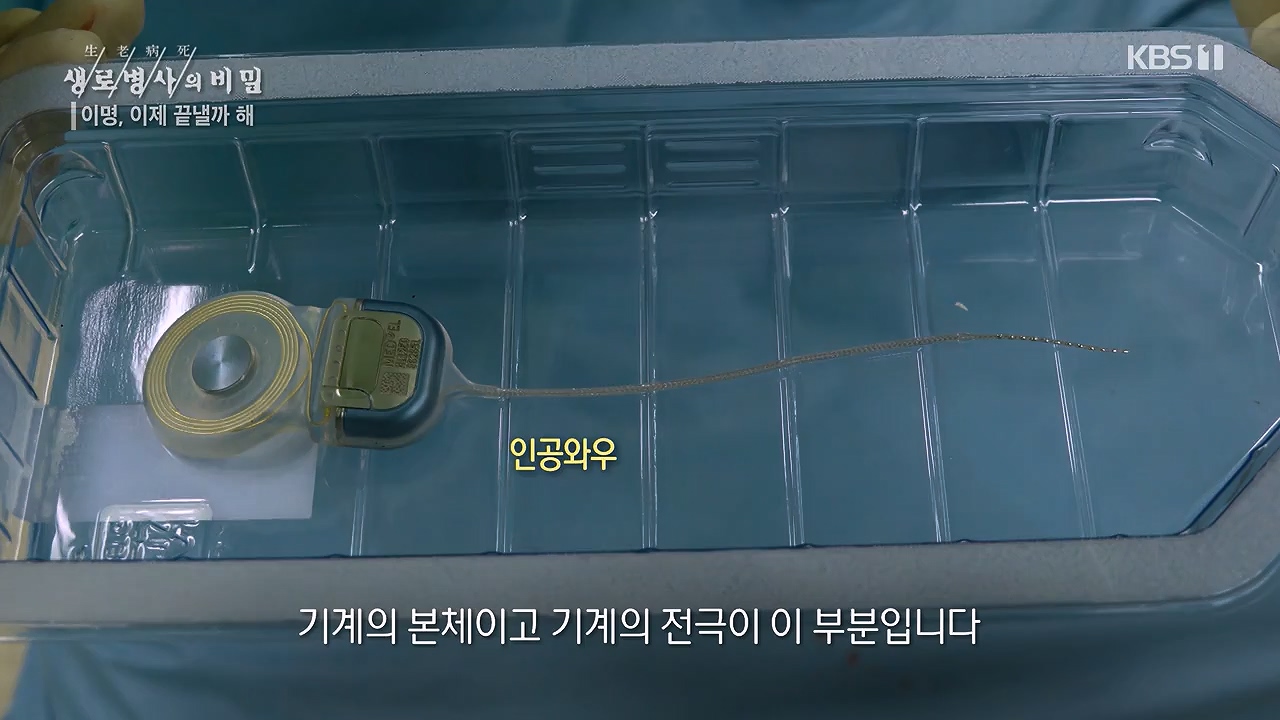 생로병사의 비밀.E883.230914p-NEXT.mp4_20230914_204615.521.jpg
