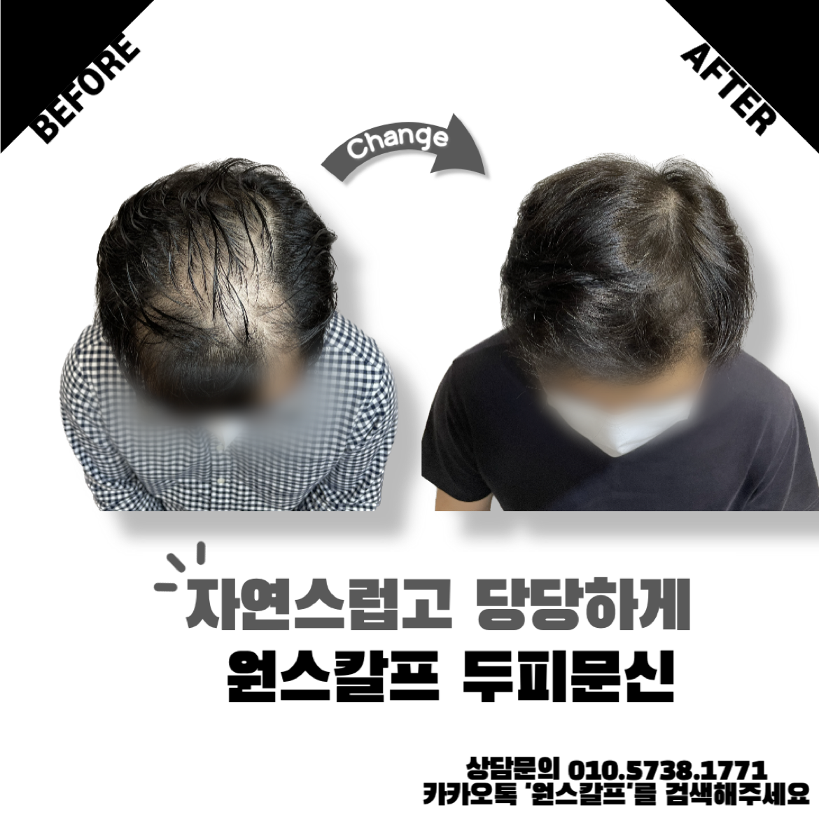  부산 모발문신 전문업체 아직도 000를 모르신다구요?