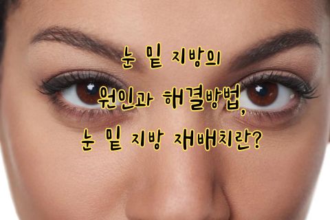 눈 밑 지방의 원인과 해결방법&#44; 눈 밑 지방 재배치란?