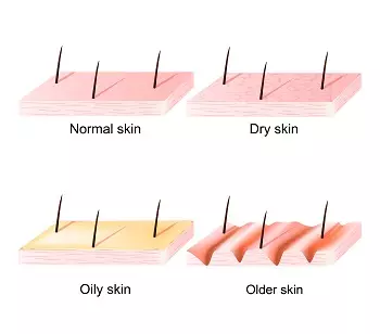 Skin type