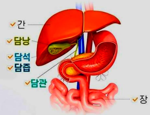  쓸개 염증, 담낭염