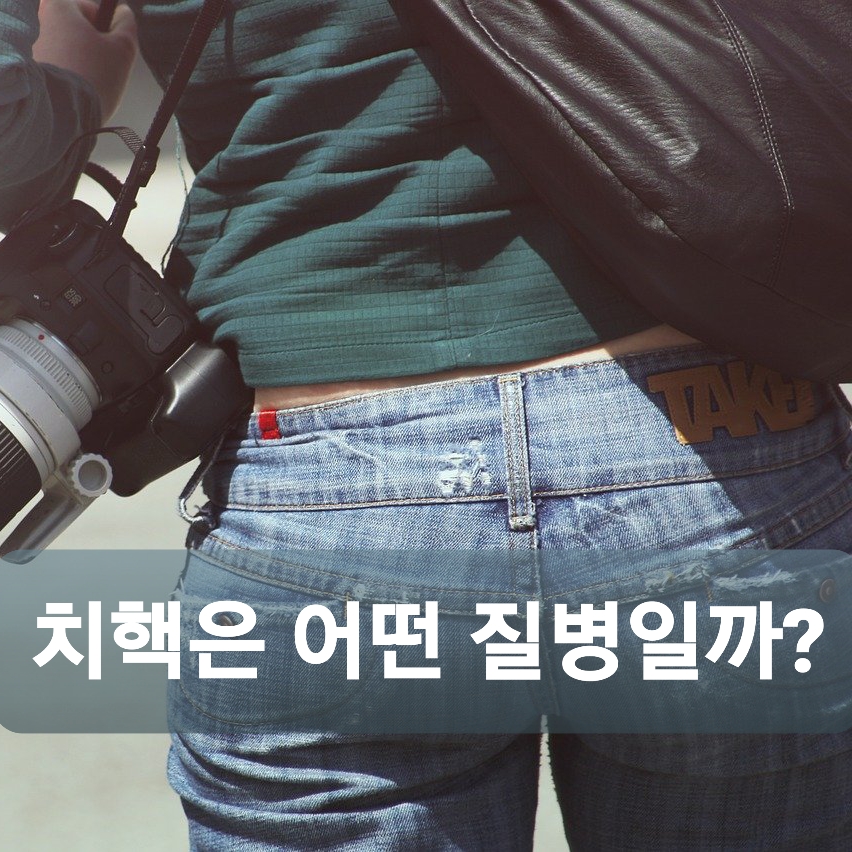  치핵 항문 주위 정맥 혈전증에 대해 알아보자