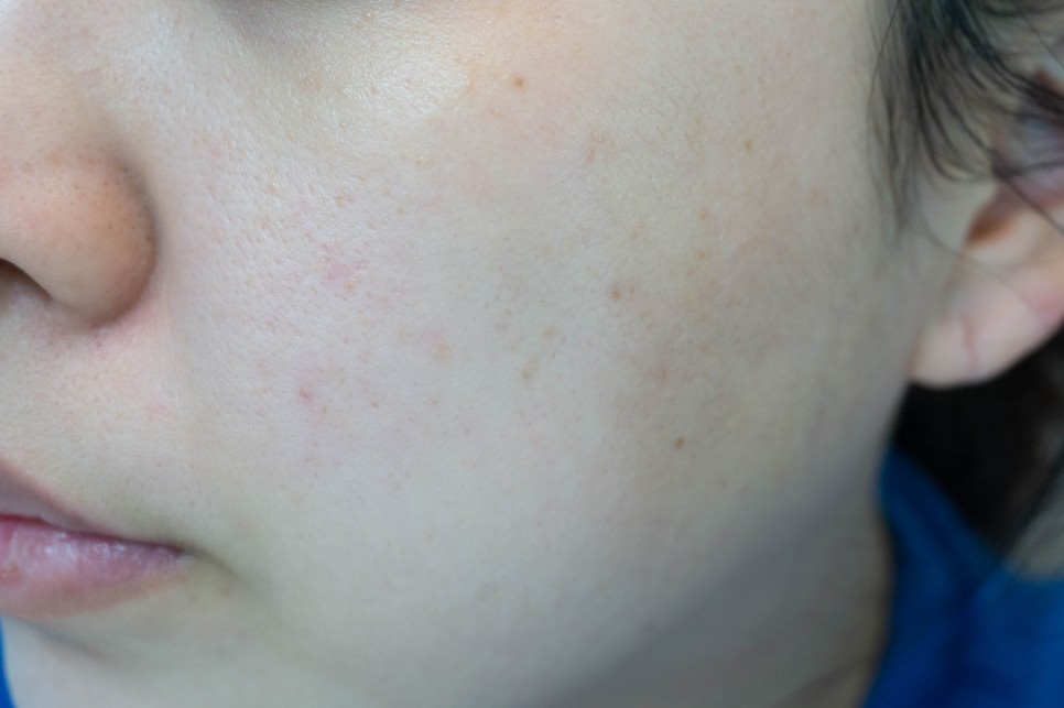 ginger 스킨케어의 시작은 이중기능성토너인 15