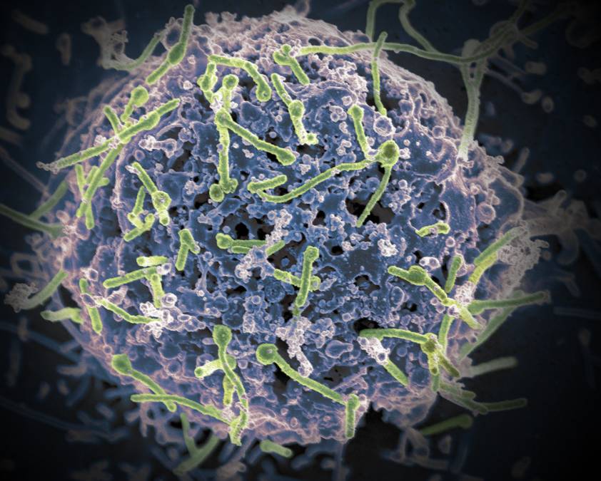 에볼라바이러스 감염 경로 및 증상&#44; 예방법: 알아두면 좋아요!