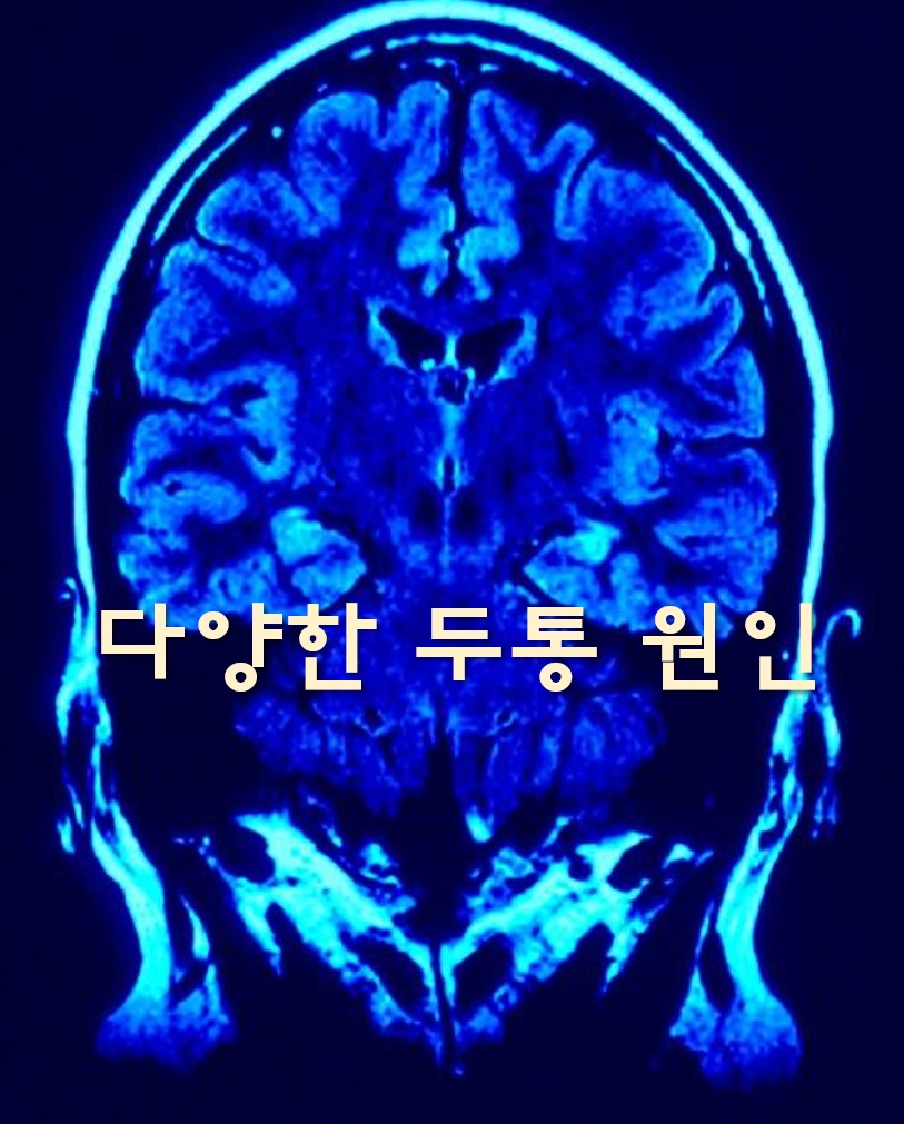  다양한 두통 원인과 머리가 아픈 이유