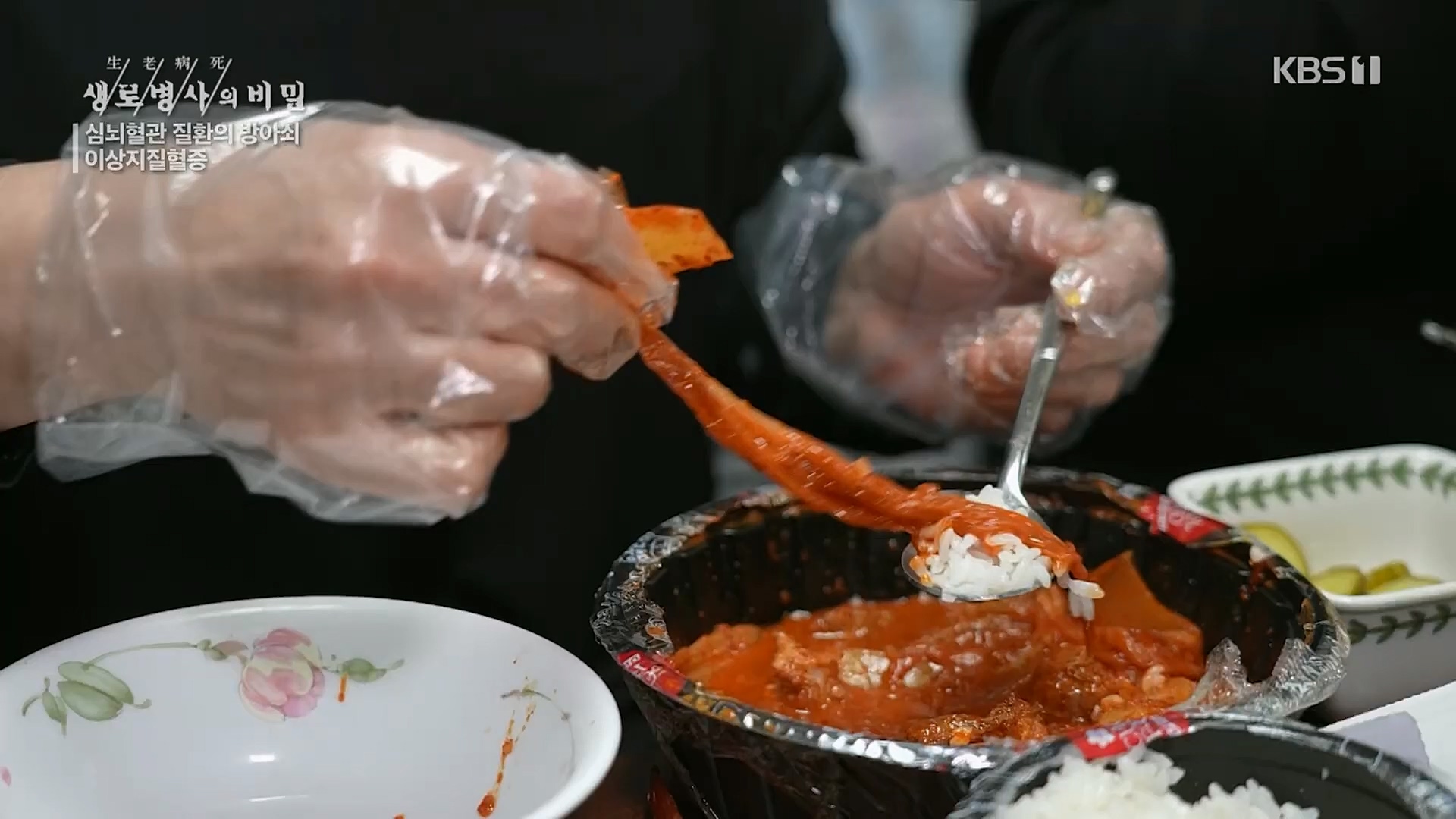 생로병사의 비밀.E862.230329p.H264-F1RST.mp4_20230330_203231.778.jpg