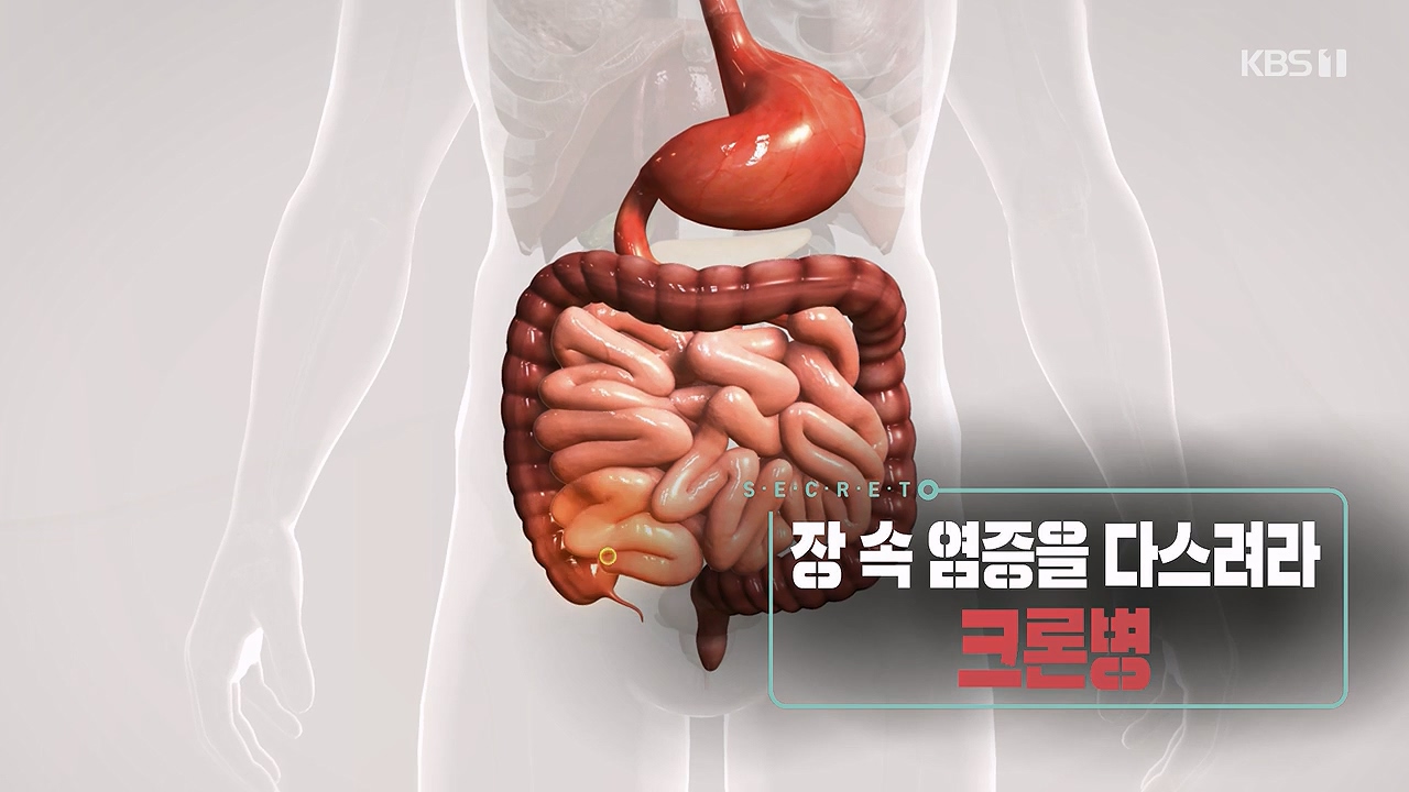 생로병사의 비밀.E884.230921p-NEXT.mp4_20230921_202833.168.jpg