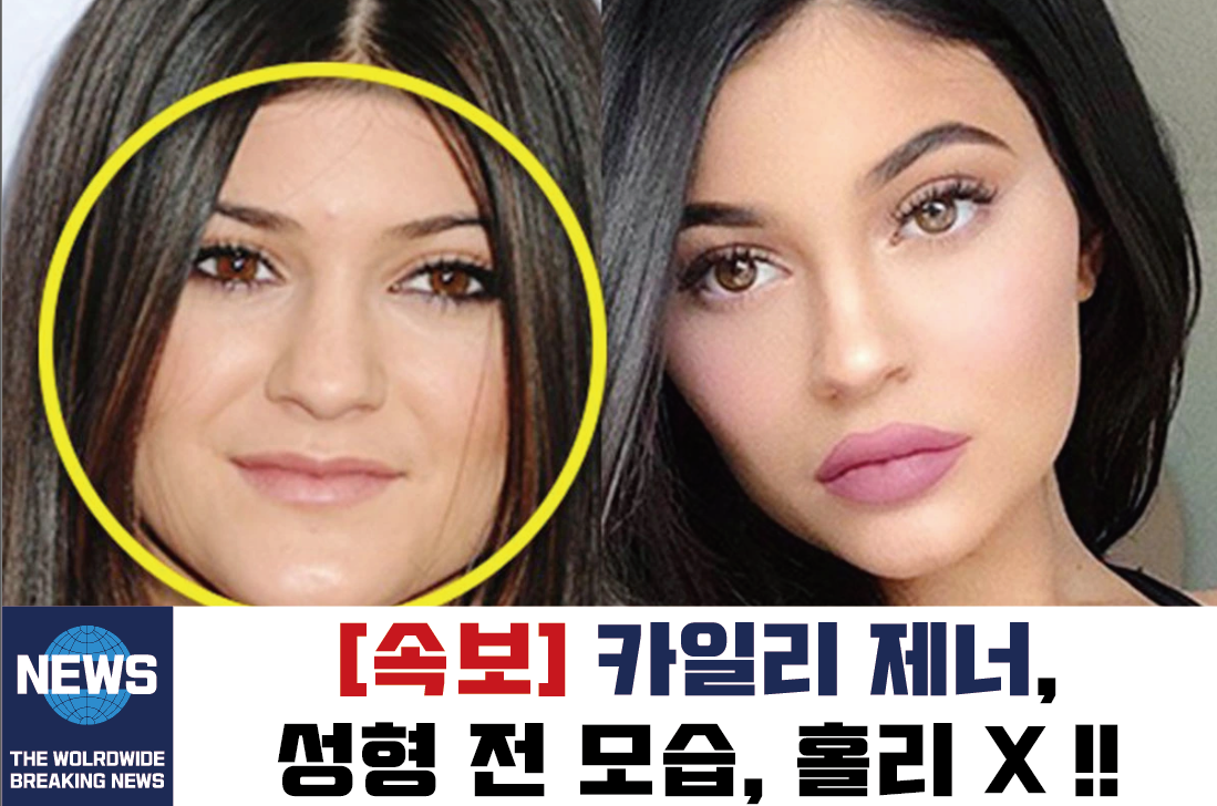  카일리 제너, 화장품 성형 전 몸매 키 인스타그램 인생 등
