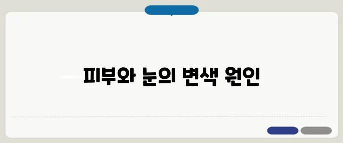 황달 증상 피부와 눈에 먼저 나타나는 변화