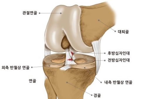 전방십자인대 파열 증상