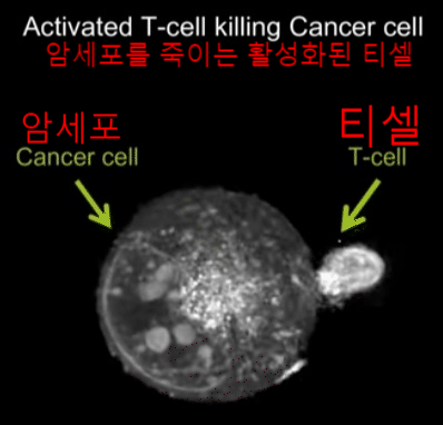  [신체 장기] 크기, 췌장암